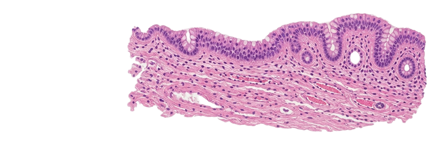 H&E stained histology slide
